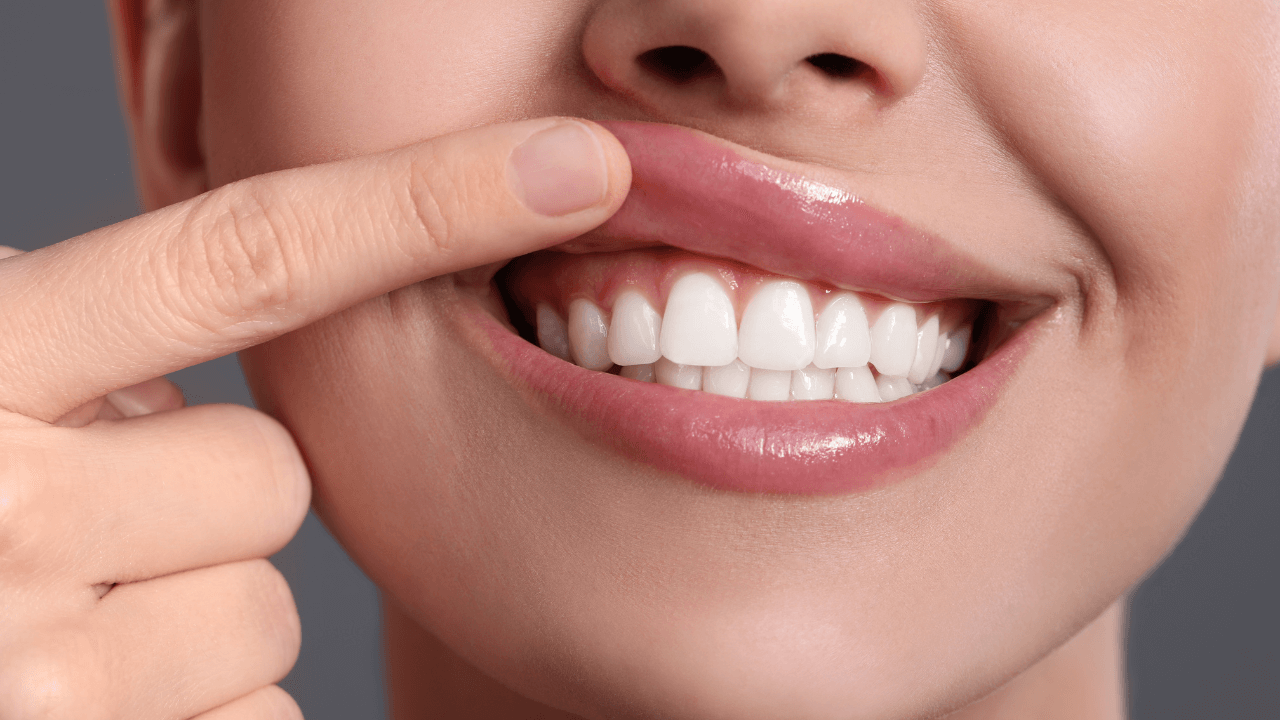 Una imagen de una encía. Gingivitis y Periodontitis.