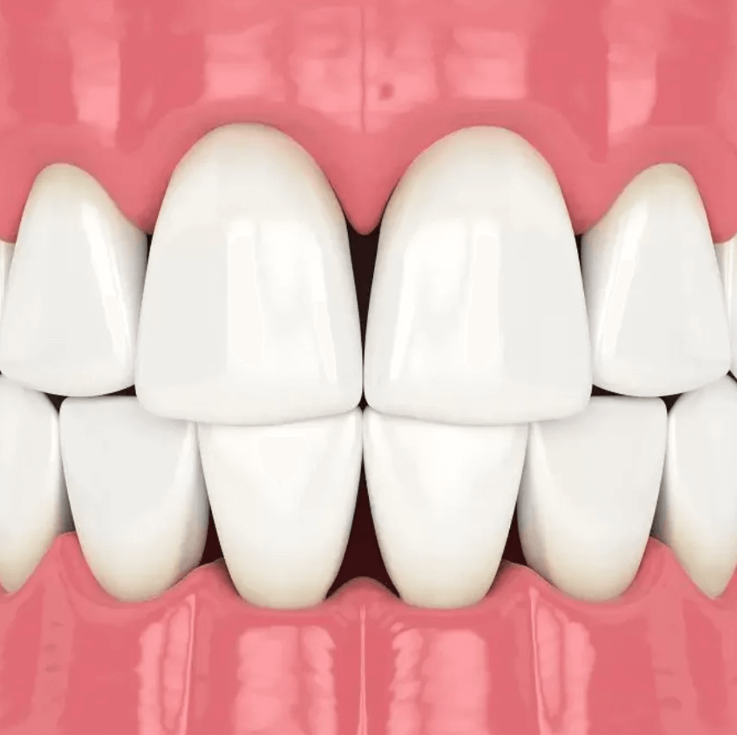 triangulos_negros_dientes