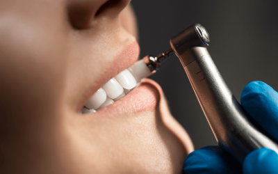 ¿Por qué es importante hacerse una limpieza dental?