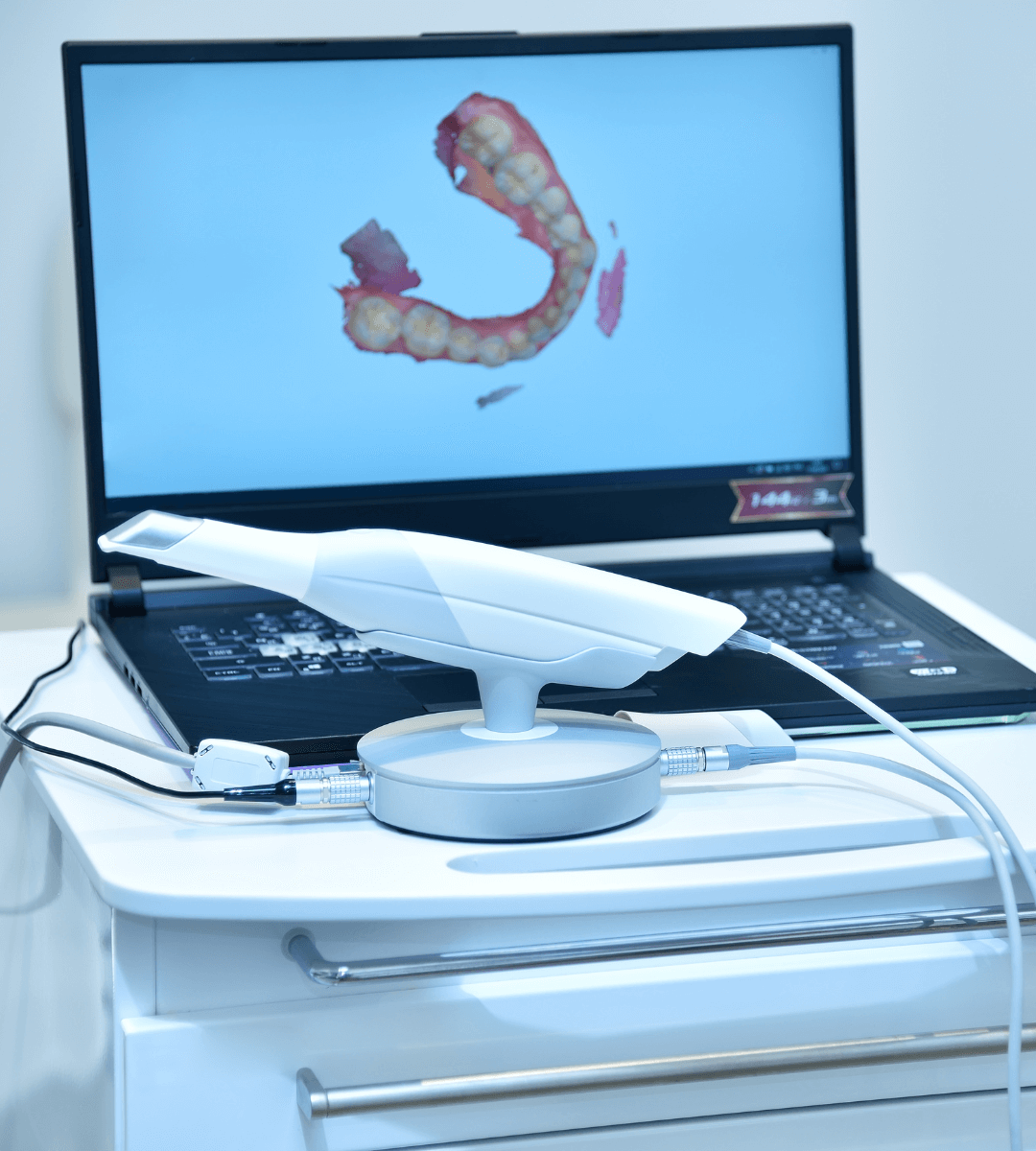 Odontóloga realizando un escáner intraoral 3D para diseñar la sonrisa digitalmente sin usar moldes de pasta.